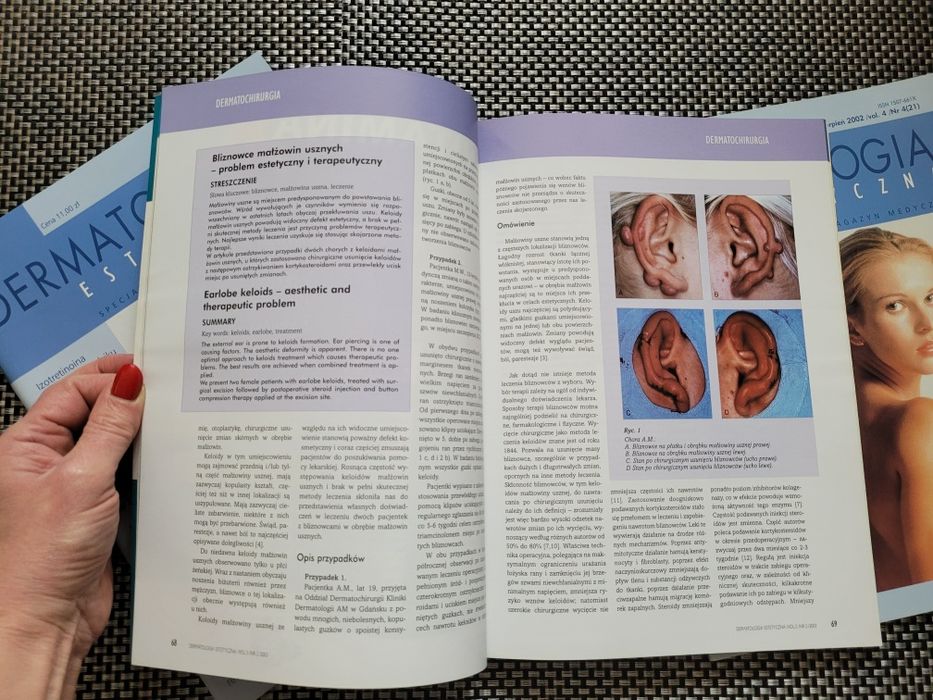 Czasopisma Dermatologia Estetyczna