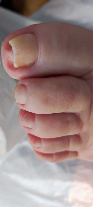 Podolog z dojazdem do domu, pedicure