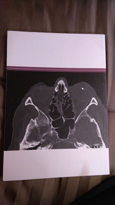 Livro Atlas Imagiologia da Órbita - novo