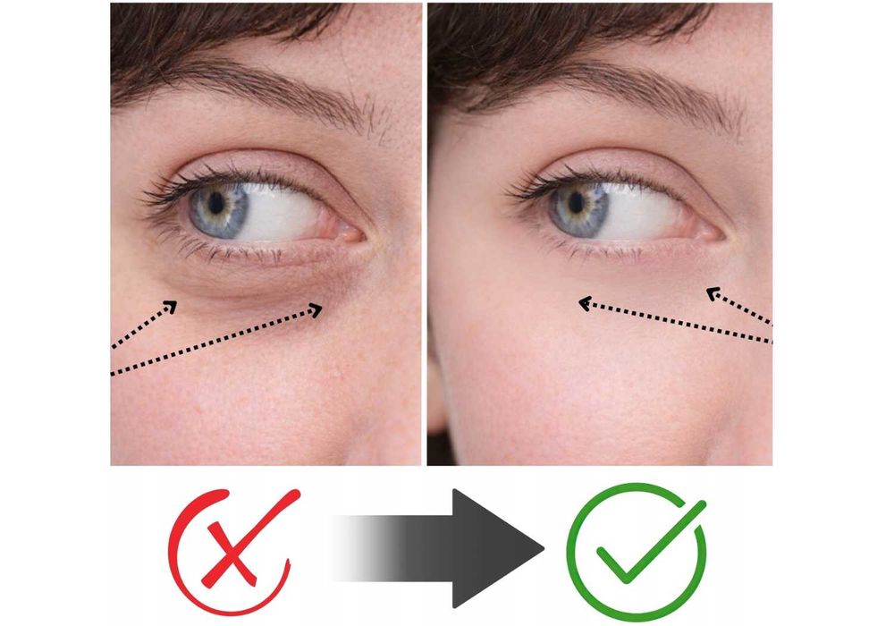 NOWOŚĆ Masażer Do Twarzy Liftingujący Mezoterapia Na Zmarszczki 6W1