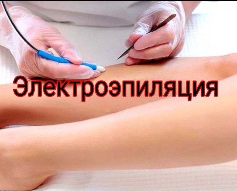 .Шугаринг.Электроэпиляция. Днепр.Обучение.Курсы