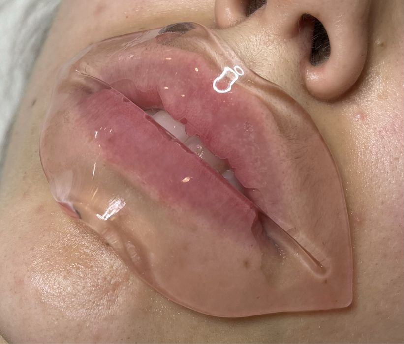 Serviço de Hydra lips