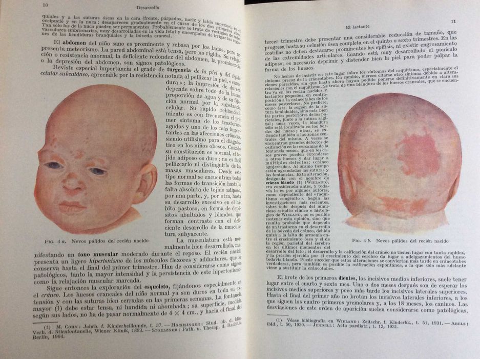 Tratado de las enfermedades del lactante. Por Finkelstein, H., 1941