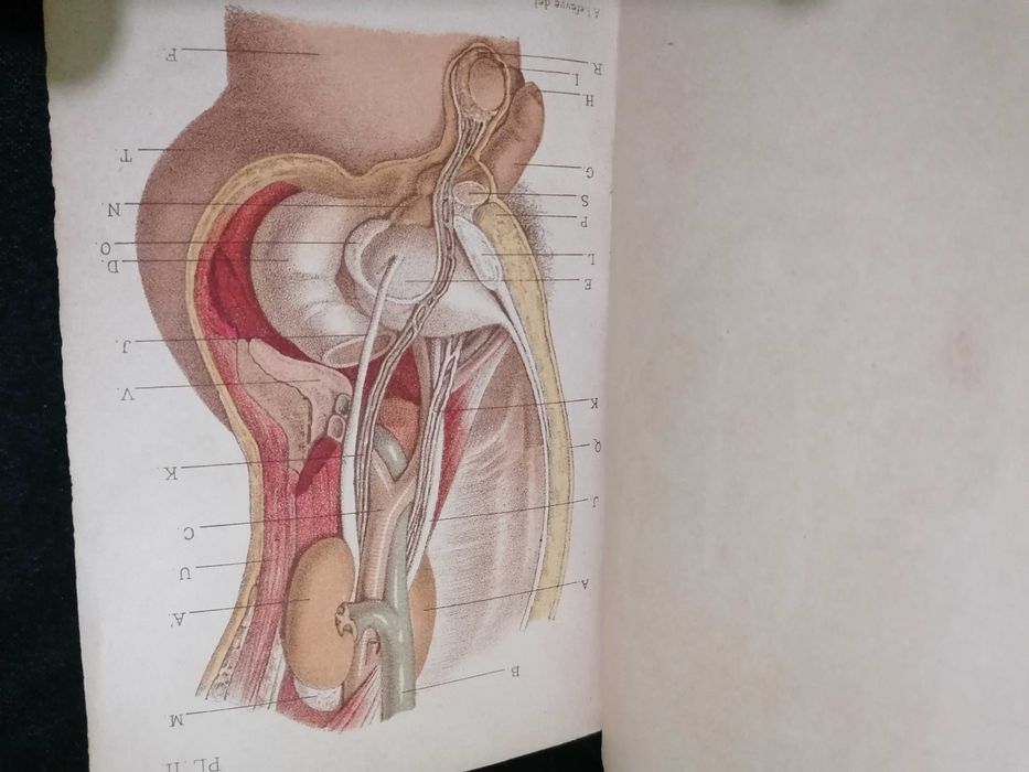 Traité Pratique des Maladies des Voies Urinaires, par Jozan Pére ,1884