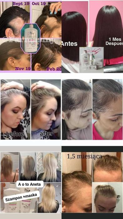 Szampon przeciw wypadaniu włosów i na szybki porost Dr TUNA Farmasi