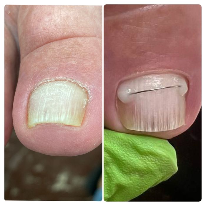 Подолог, педикюр Кривий Ріг