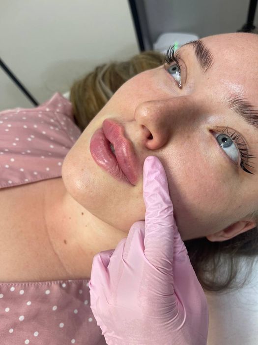 Косметолог, увеличить губы, пілінг, контурна пластика