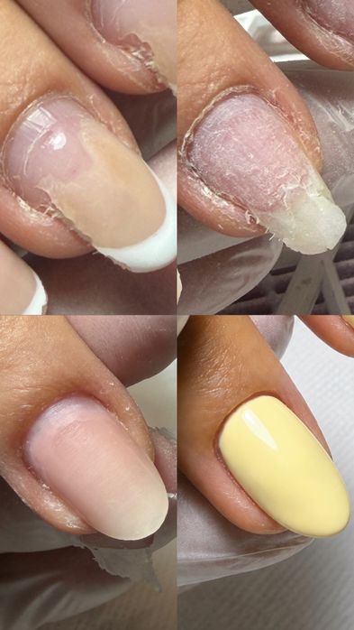 Formacao de Unhas em Gel