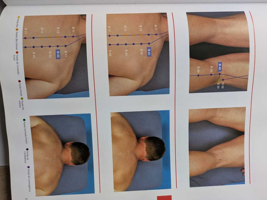 Atlas Gráfico de Acupuntura- ilustrado