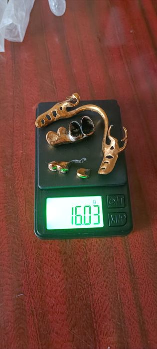 Стоматологическая позолота коронки