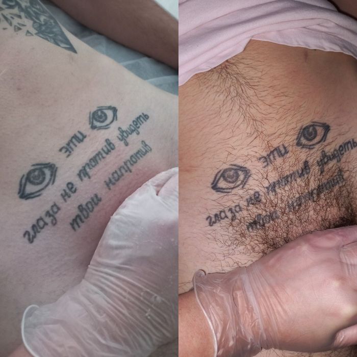 Депіляція для жінок і чоловіків, вагітних, підлітків