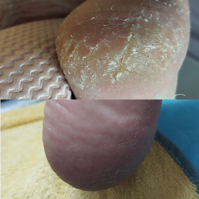 Pedy Clean, estética e cuidados específicos dos pés