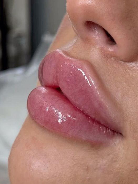 АКЦИЯ СКИДКИ Нужны МОДЕЛИ на увеличение губ для портфолио