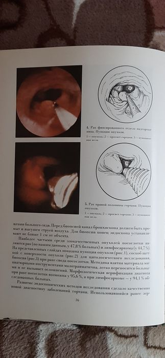 Атлас онкологічних операцій