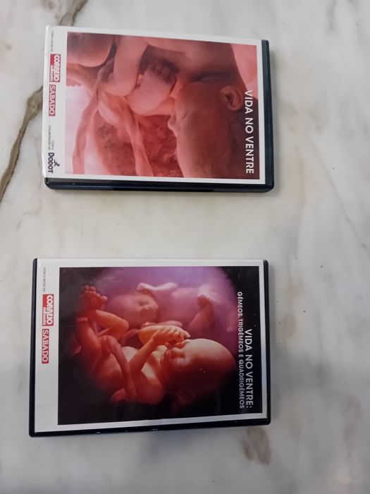Conjunto de 2 Dvds A Vida No Ventre