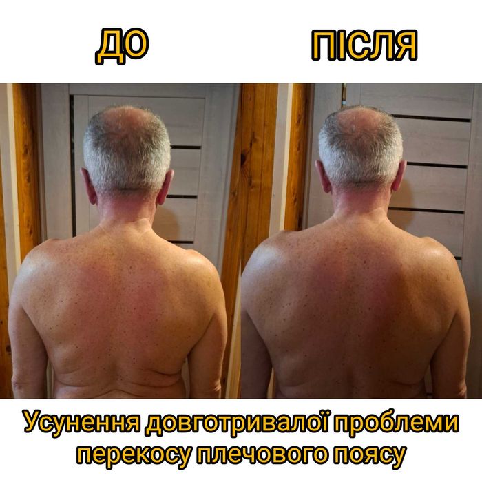 Масаж, міопресура, консультування, реабілітація. Трускавець