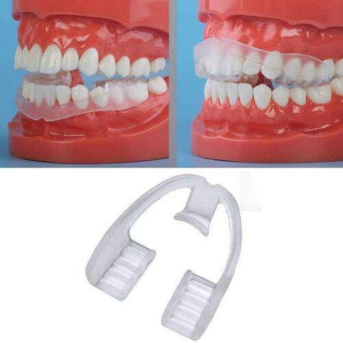 Aparelho ortodôntico anti-bruxismo (ranger de dentes)