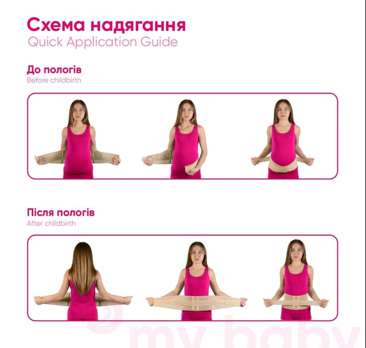 Бандаж, післяпологовий бандаж