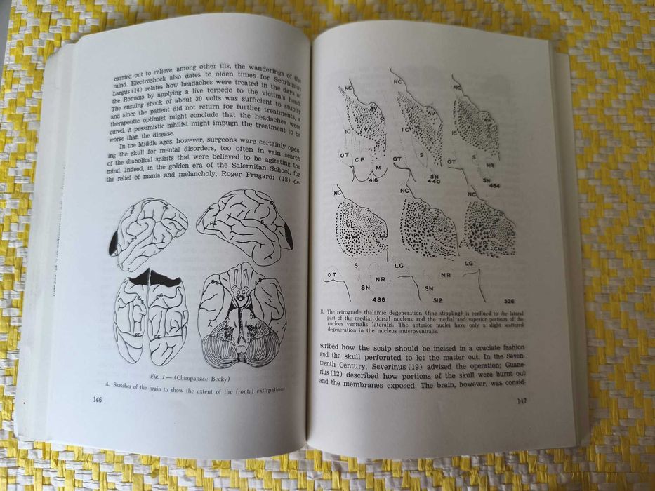 Egas Moniz Centenary . Scintific Reports