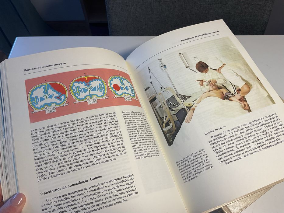 Coleção “O Nosso Corpo” 4 Livros Medicina Anos 80