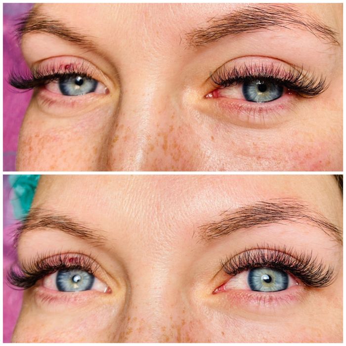 Обучение наращиванию ресниц.Увеличение губ.Ботулинотерапия.м.Гагарина