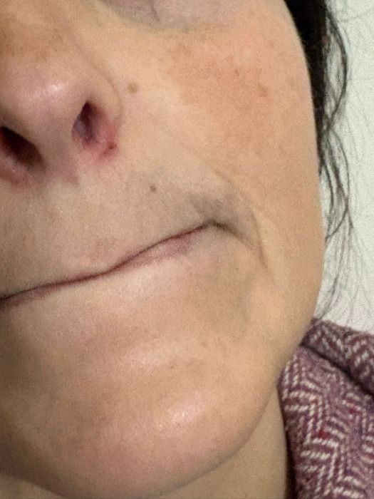 Epilação à linha ao domicilio