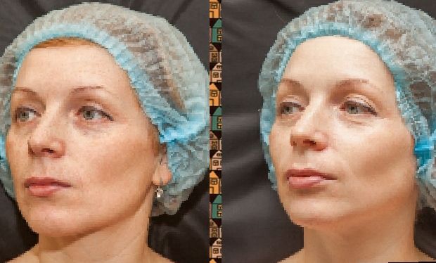 Косметолог естетист. Метро КПІ