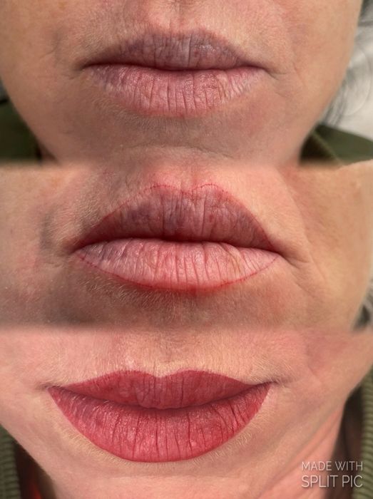 Micropigmentaçāo labial