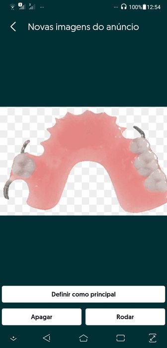 Troco vendo confecção de Próteses !!!