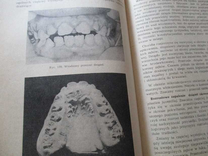 Stomatologia zachowawcza/Zarys stomatologii dziecięcej/stomatologia
