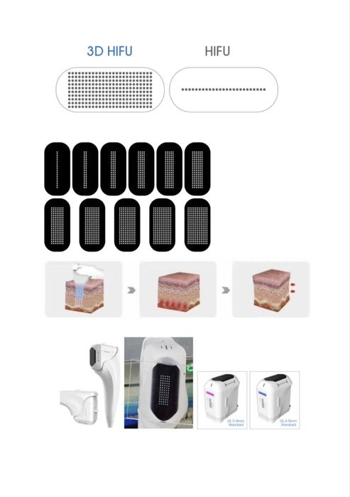 HIFU 3D + Radiofrekfencja Mikroigłowa