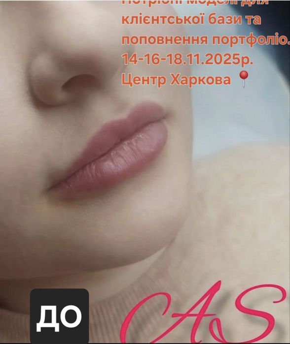 Косметолог/Ботокс/Збільшення губ/МОДЕЛІ