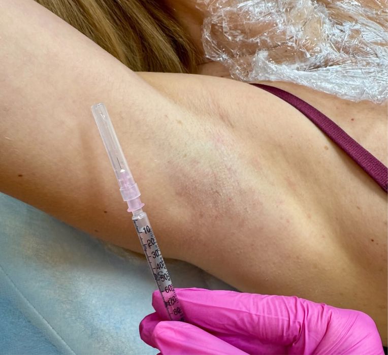 Акція на всю контурну пластику обличчя. Збільшення губ, ботокс, біо