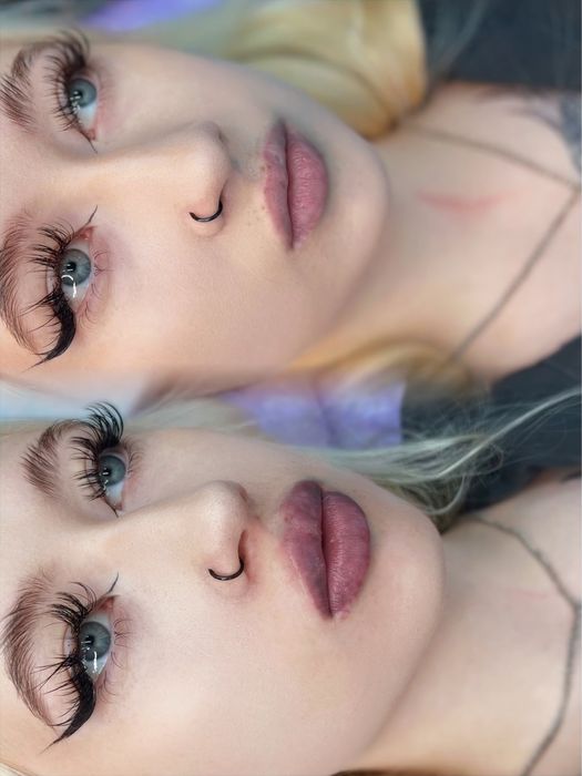 Акція. Контурна пластика губ. Запоріжжя