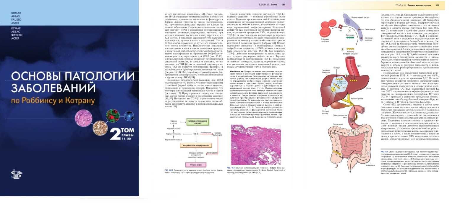 Основы патологии заболеваний по Роббинсу и Котрану В. Кумар - 3 тома