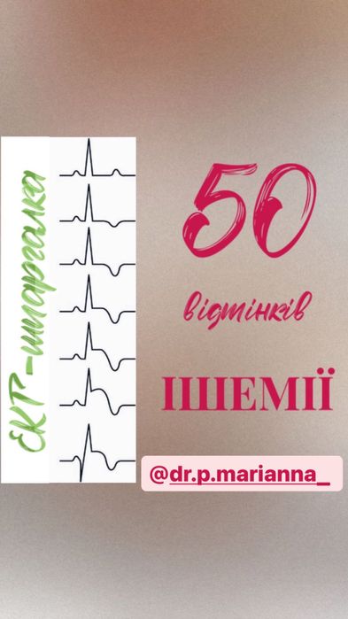 ЕКГ шпаргалка «50 відтінків ішемії» кардіограма кардіологія