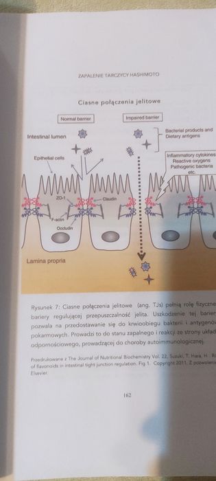 Zapalenie tarczycy  - tanio
