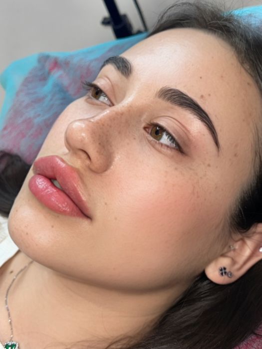 Увеличение губ Одесса Центр