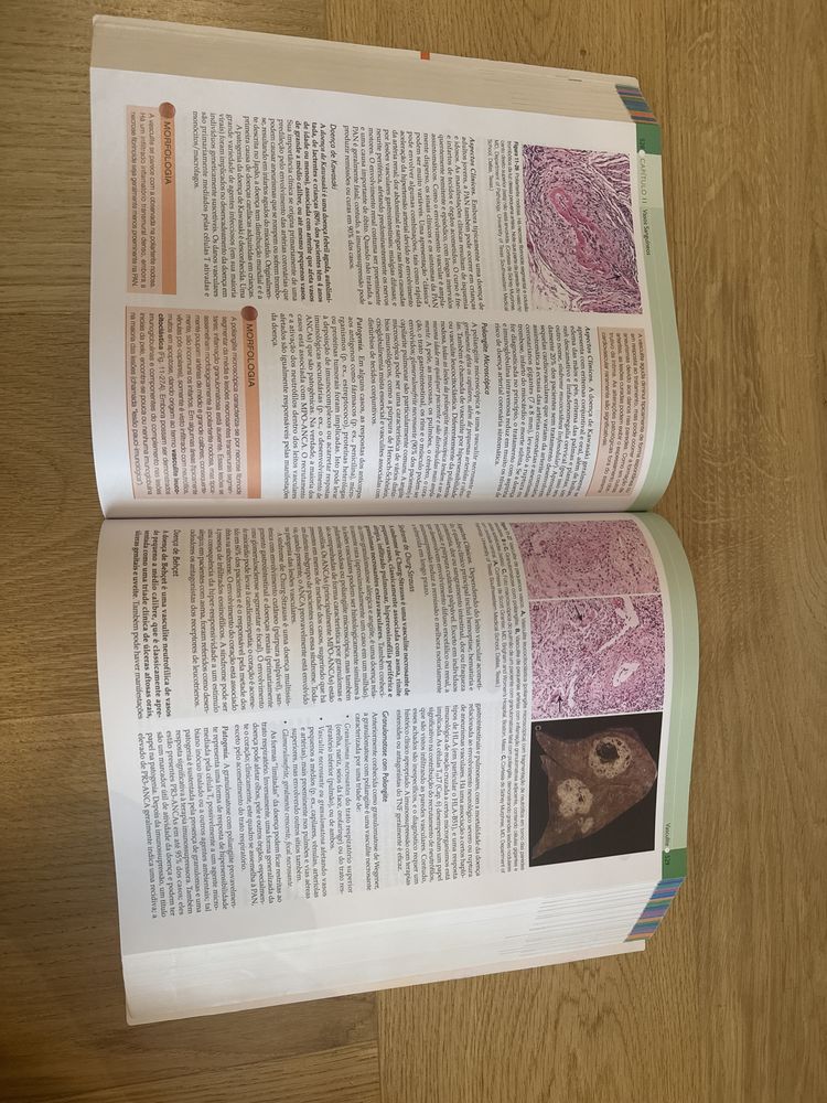 Robbins & Cotran Patologia Bases patológicas das doenças 9° edição.