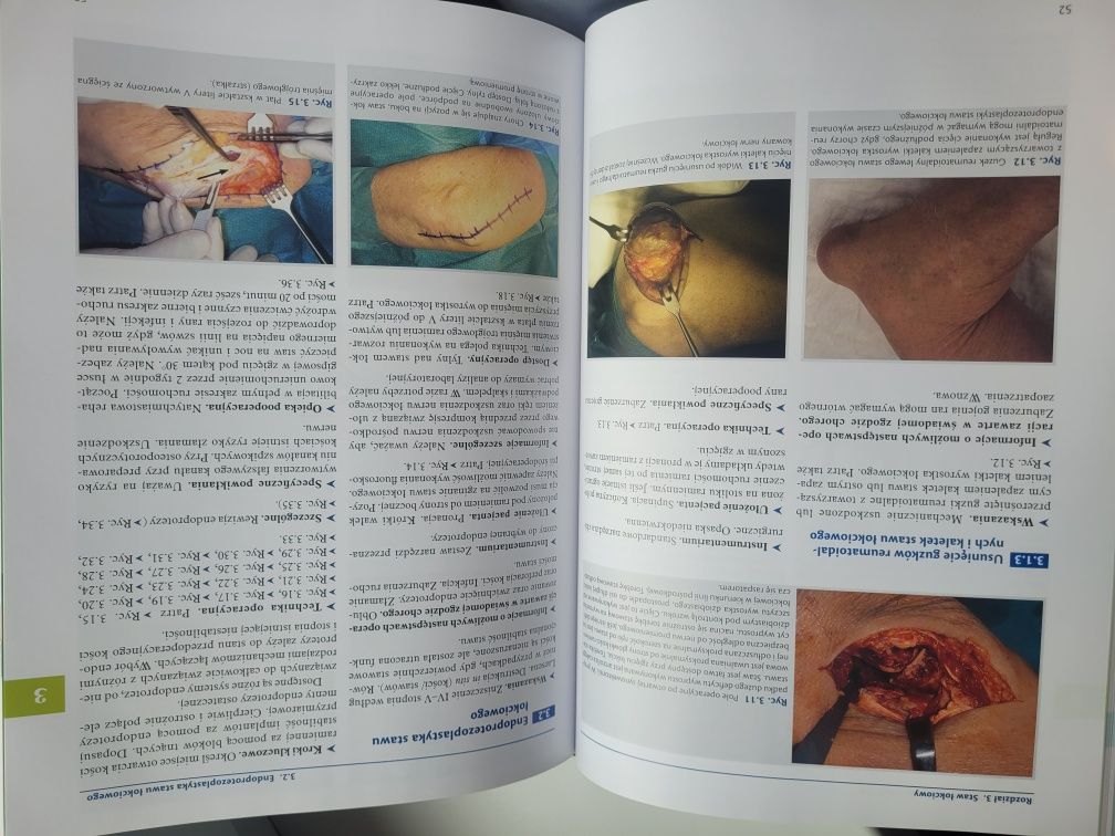 Reumoortopedia Sell Rehart Kowalczewski Medisfera 2020r.