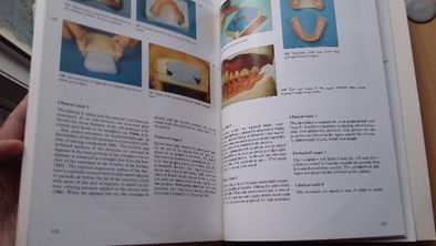"Complete Prosthodontics: Problems, Diagnosis Management" Grant Heath