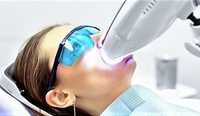 Отбеливание зубов стоматология
