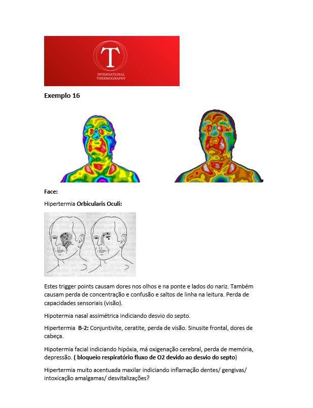 Seja Especialista em Termografia  e Transforme Sua Carreira na Saúde!