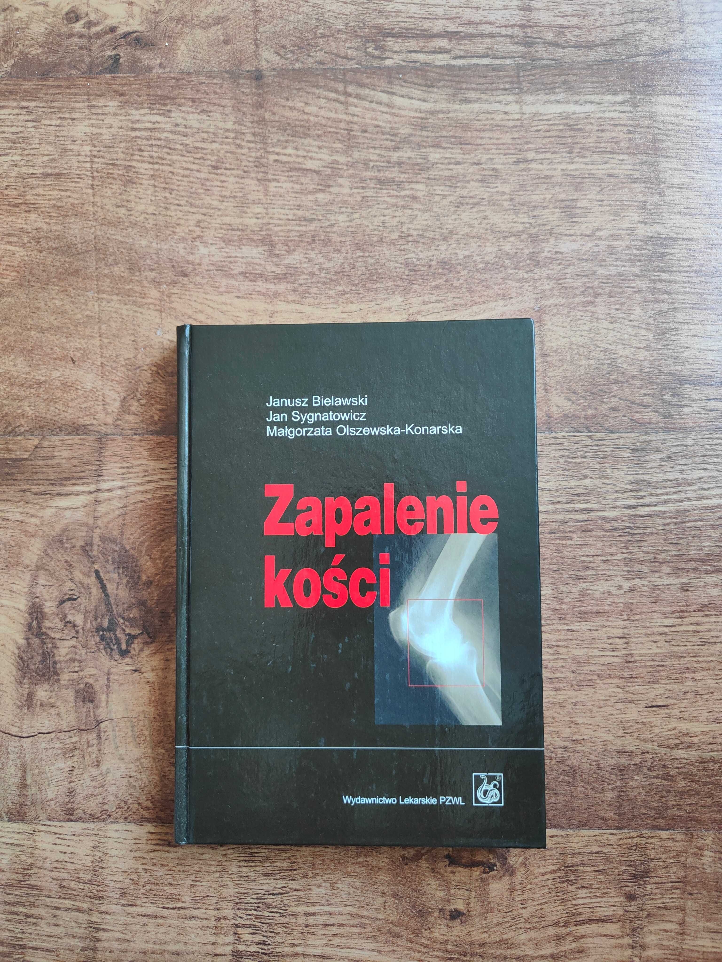 Zapalenie kości Janusz Bielawski, Jan Sygnatowicz, Olszewska-Konarska