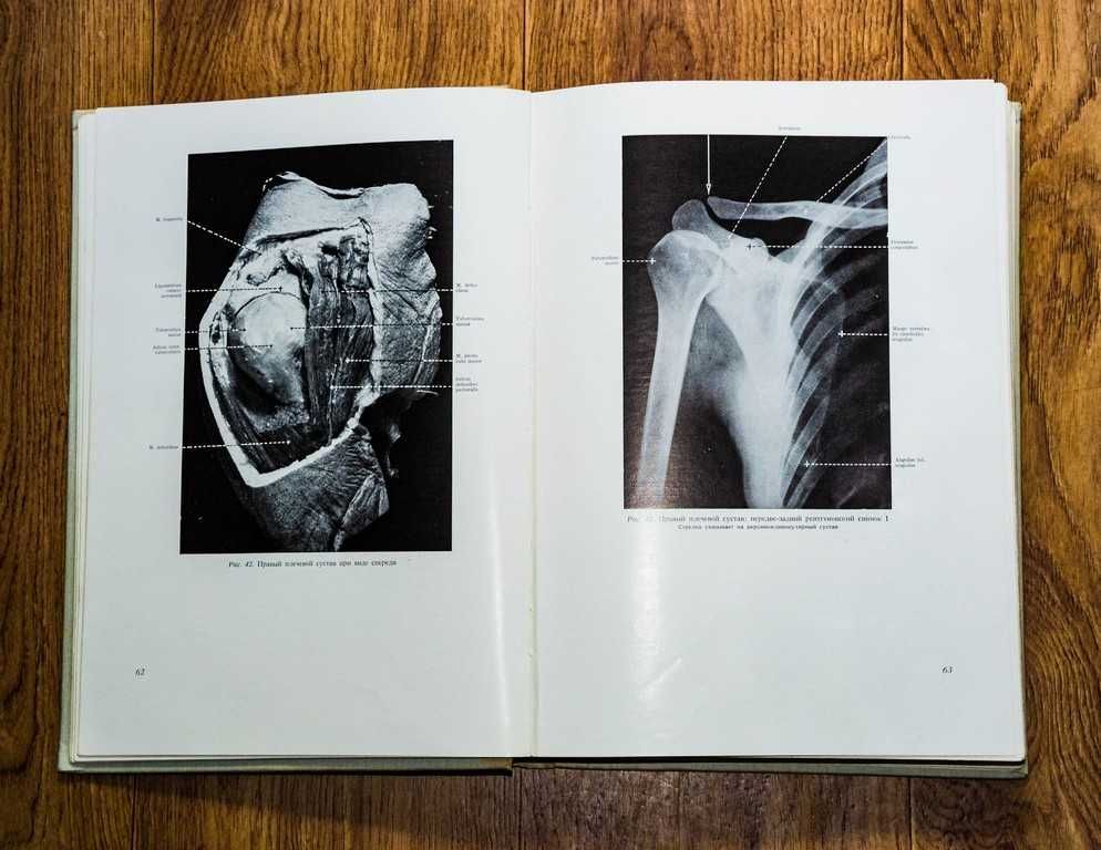 Рентгеновская анатомия 1961г.
