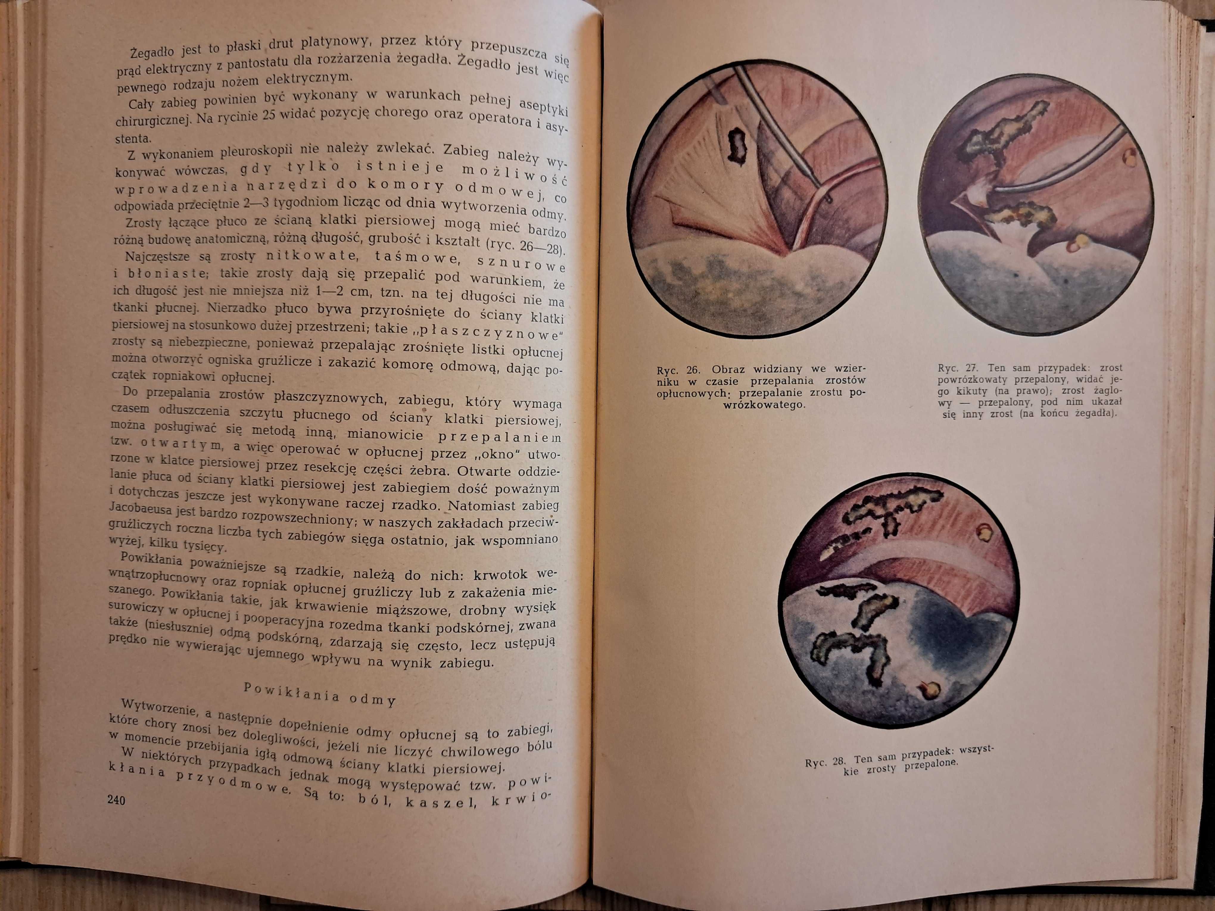 Ftyzjatria - J. Misiewicz - 1954r - podręcznik dla studentów medycyny