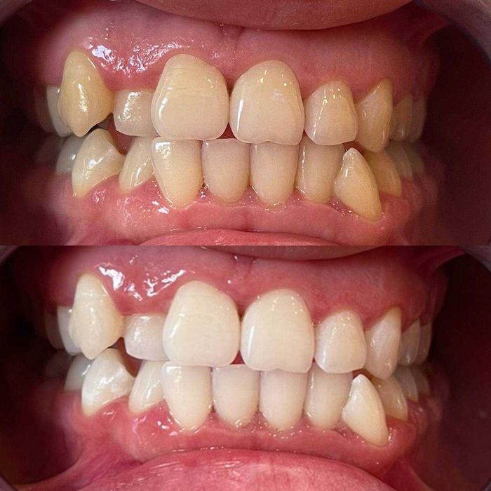 Косметичний бізнес / Франшиза відбілювання зубів Smile LAB