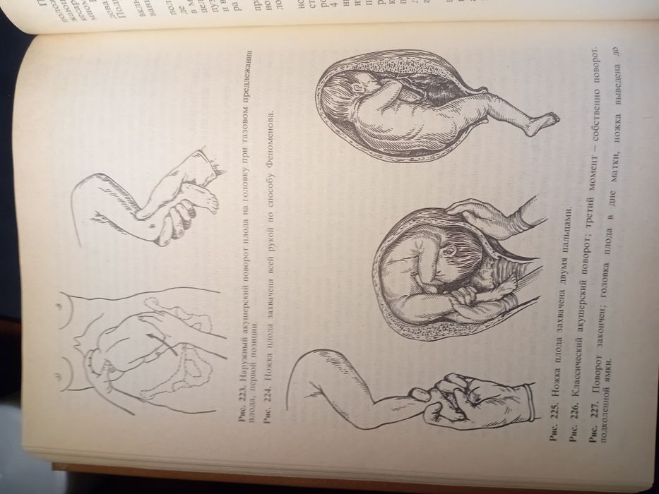 Акушерство підручник з ілюстраціями 1986г