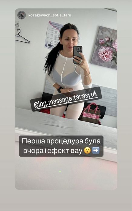 Апаратний LPG масаж корекція фігури для жінок Крюківщина 400 грн