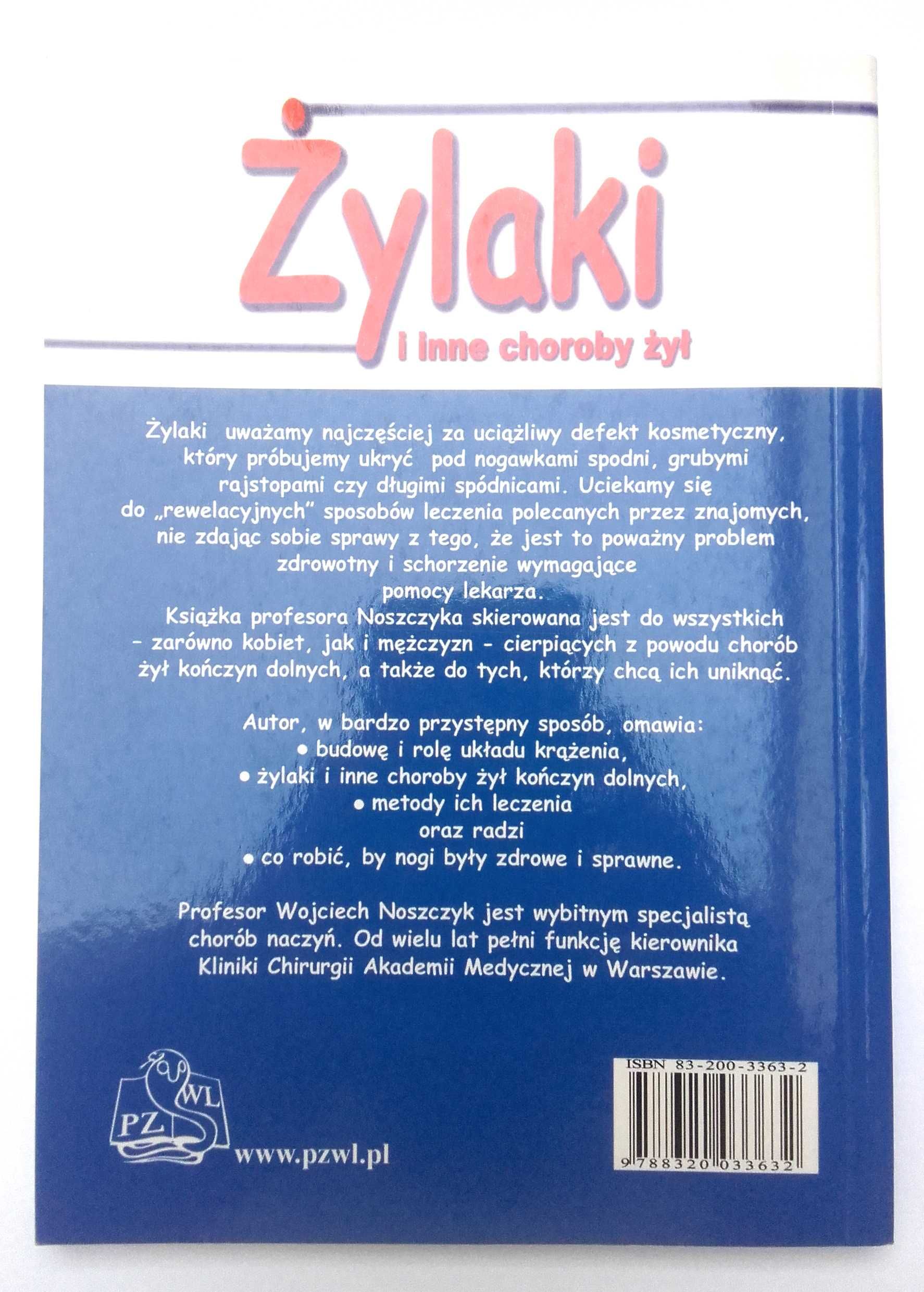 Żylaki i inne choroby żył - Wojciech Noszczyk hemoroidy